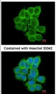 Immunocytochemistry/Immunofluorescence: RGS17 Antibody [NBP1-33694] - Paraformaldehyde-fixed A431, using antibody at 1:200 dilution.