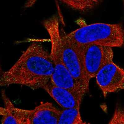 Immunocytochemistry/Immunofluorescence: RGS17 Antibody [NBP2-58574] - Staining of human cell line SH-SY5Y shows localization to vesicles.