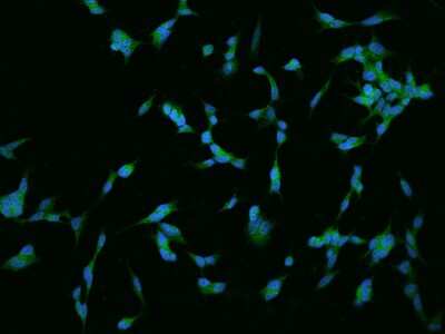 Immunocytochemistry/Immunofluorescence: RGS17 Antibody [NBP2-97280] - Immunofluorescence staining of RGS17 in SHSY5Y cells. Cells were fixed with 4% PFA, permeabilzed with 0.1% Triton X-100 in PBS, blocked with 10% serum, and incubated with rabbit anti-Human RGS17 polyclonal antibody (dilution ratio 1:200) at 4C overnight. Then cells were stained with the Alexa Fluor(R)488-conjugated Goat Anti-rabbit IgG secondary antibody (green) and counterstained with DAPI (blue).Positive staining was localized to Cytoplasm.