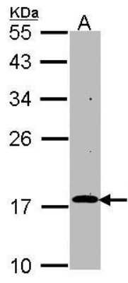 Western Blot: RGS17 Antibody [NBP1-33694] - Hep G2 lysates using NBP1-33694 at a dilution of 1:1000. 30ug whole cell lysate loaded on 12% SDS PAGE gel.