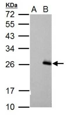 Western Blot: RGS17 Antibody [NBP1-33694] - Sample (30 ug of whole cell lysate) A: Non-transfected 293T lysates B: RGS17 transfected 293T lysates 12% SDS PAGE; antibody diluted at 1:5000.