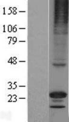 Western Blot RGS17 Overexpression Lysate