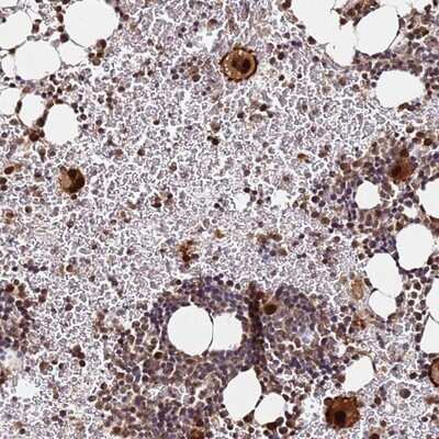 Immunohistochemistry-Paraffin: RGS18 Antibody [NBP1-92329] - Staining of human bone marrow shows strong nuclear positivity in megakaryocytes.