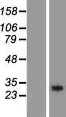 Western Blot: RGS18 Overexpression Lysate (Adult Normal) [NBL1-15324] Left-Empty vector transfected control cell lysate (HEK293 cell lysate); Right -Over-expression Lysate for RGS18.