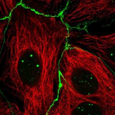 Immunocytochemistry/Immunofluorescence: RGS19 Antibody [NBP2-68724] - Staining of human cell line CACO-2 shows localization to nucleoli fibrillar center & cell junctions.