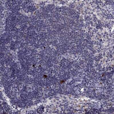 Immunohistochemistry-Paraffin: RGS19 Antibody [NBP2-62666] - Immunohistochemical staining of human lymph node shows high expression.