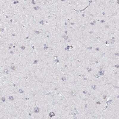 Immunohistochemistry-Paraffin: RGS19 Antibody [NBP2-62666] - Staining of human cerebral cortex shows low expression as expected.