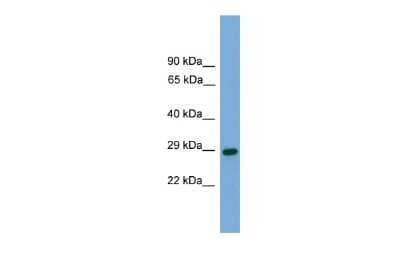 Western Blot: RGS19 Antibody [NBP2-88150] - WB Suggested Anti-RGS19 Antibody Titration: 0.2-1 ug/ml. ELISA Titer: 1:1562500. Positive Control: Human brain