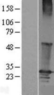 Western Blot: RGS19 Overexpression Lysate (Adult Normal) [NBL1-15325] Left-Empty vector transfected control cell lysate (HEK293 cell lysate); Right -Over-expression Lysate for RGS19.