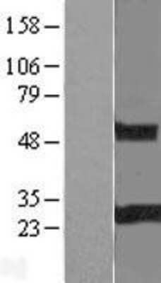 Western Blot: RGS19 Overexpression Lysate (Adult Normal) [NBL1-15326] Left-Empty vector transfected control cell lysate (HEK293 cell lysate); Right -Over-expression Lysate for RGS19.