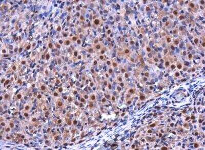 Immunohistochemistry-Paraffin: RGS2 Antibody [NBP1-32284] - Rat ovary. RGS2 antibody diluted at 1:500. Antigen Retrieval: Citrate buffer, pH 6.0, 15 min. 