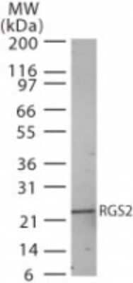 Western Blot: RGS2 Antibody [NB100-56736] - Western bot analysis of RGS2 in human heart lysate using RGS2 antibody at 2 ug/ml.