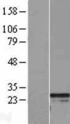 Western Blot: RGS2 Overexpression Lysate (Adult Normal) [NBL1-15327] Left-Empty vector transfected control cell lysate (HEK293 cell lysate); Right -Over-expression Lysate for RGS2.