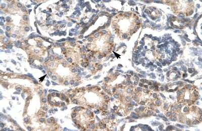 Immunohistochemistry-Paraffin: RGS20 Antibody [NBP1-54885] - Human kidney Tissue, antibody concentration 4-8ug/ml. Cells with positive label: renal corpuscle cells (indicated with arrows) 400X magnification.