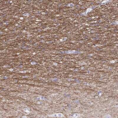 Immunohistochemistry-Paraffin RGS20 Antibody