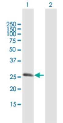 Western Blot: RGS20 Antibody [H00008601-B01P] - Analysis of RGS20 expression in transfected 293T cell line by RGS20 polyclonal antibody.  Lane 1: RGS20 transfected lysate(26.51 KDa). Lane 2: Non-transfected lysate.