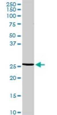 Western Blot: RGS20 Antibody [H00008601-D01P] - Analysis of RGS20 expression in mouse spleen.