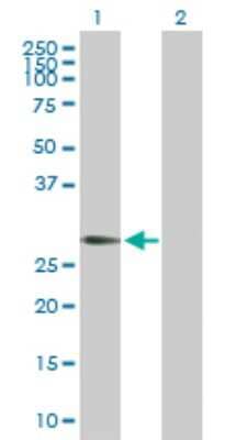 Western Blot: RGS20 Antibody [H00008601-D01P] - Analysis of RGS20 expression in transfected 293T cell line by RGS20 polyclonal antibody.Lane 1: RGS20 transfected lysate(27.10 KDa).Lane 2: Non-transfected lysate.
