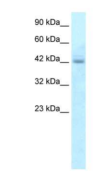 Western Blot: RGS20 Antibody [NBP1-54839] - HepG2 cell lysate, concentration 5.0ug/ml.