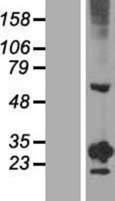 Western Blot RGS20 Overexpression Lysate