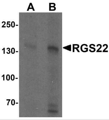 Western Blot RGS22 Antibody - BSA Free