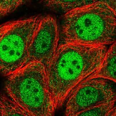 Immunocytochemistry/ Immunofluorescence RGS3 Antibody