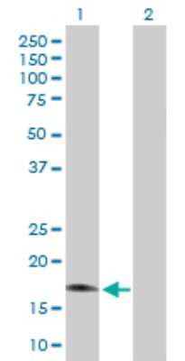 Western Blot: RGS3 Antibody [H00005998-B01P] - Analysis of RGS3 expression in transfected 293T cell line by RGS3 polyclonal antibody.  Lane 1: RGS3 transfected lysate(18.48 KDa). Lane 2: Non-transfected lysate.