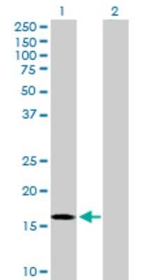 Western Blot: RGS3 Antibody [H00005998-D01P] - Analysis of RGS3 expression in transfected 293T cell line by RGS3 polyclonal antibody.Lane 1: RGS3 transfected lysate(19.50 KDa).Lane 2: Non-transfected lysate.