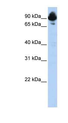 Western Blot: RGS3 Antibody [NBP1-58312] - Human Heart lysate, concentration 0.2-1 ug/ml.