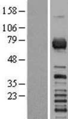 Western Blot RGS3 Overexpression Lysate