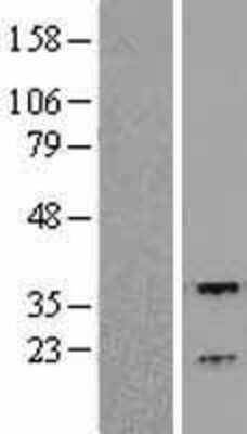 Western Blot: RGS3 Overexpression Lysate (Adult Normal) [NBL1-15331] Left-Empty vector transfected control cell lysate (HEK293 cell lysate); Right -Over-expression Lysate for RGS3.