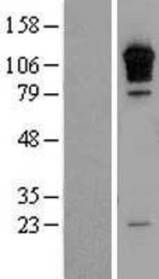 Western Blot RGS3 Overexpression Lysate