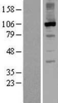 Western Blot RGS3 Overexpression Lysate