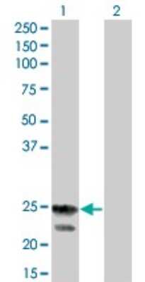 Western Blot: RGS4 Antibody (2B2) [H00005999-M01] - Analysis of RGS4 expression in transfected 293T cell line by RGS4 monoclonal antibody (M01), clone 2B2.Lane 1: RGS4 transfected lysate(23.3 KDa).Lane 2: Non-transfected lysate.
