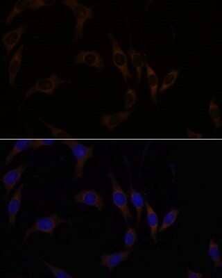 Immunocytochemistry/Immunofluorescence: RGS4 Antibody [NBP2-94071] - Analysis of L929 cells using RGS4 at dilution of 1:100. Blue: DAPI for nuclear staining.