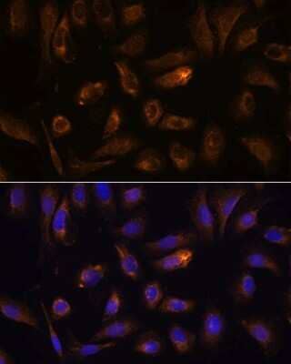 Immunocytochemistry/Immunofluorescence: RGS4 Antibody [NBP2-94071] - Analysis of U-2 OS cells using RGS4 at dilution of 1:100. Blue: DAPI for nuclear staining.