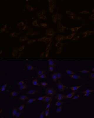 Immunocytochemistry/Immunofluorescence: RGS4 Antibody [NBP2-94071] - Immunofluorescence analysis of C6 cells using RGS4 antibody (NBP2-94071) at dilution of 1:100. Blue: DAPI for nuclear staining.