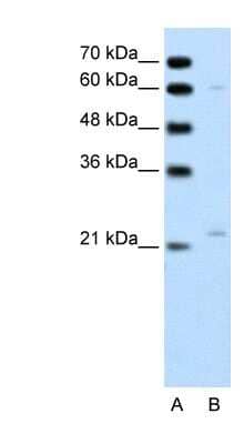 Western Blot: RGS4 Antibody [NBP1-58901] - Jurkat cell lysate, concentration 0.2-1 ug/ml.