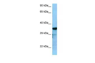 Western Blot: RGS4 Antibody [NBP2-82339] - WB Suggested Anti-RGS4 Antibody. Titration: 1.0 ug/ml. Positive Control: HepG2 Whole Cell