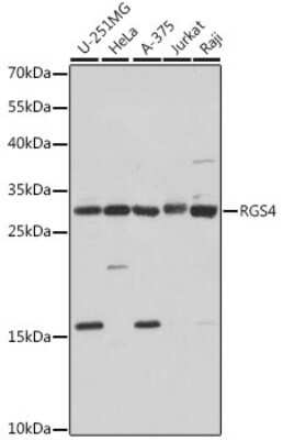 Western Blot: RGS4 Antibody [NBP2-94071] - Analysis of extracts of various cell lines, using RGS4 at 1:1000 dilution. Secondary antibody: HRP Goat Anti-Rabbit IgG (H+L) at 1:10000 dilution. Lysates/proteins: 25ug per lane. Blocking buffer: 3% nonfat dry milk in TBST. Detection: ECL Basic Kit . Exposure time: 1s.