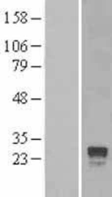 Western Blot: RGS4 Overexpression Lysate (Adult Normal) [NBL1-15334] Left-Empty vector transfected control cell lysate (HEK293 cell lysate); Right -Over-expression Lysate for RGS4.