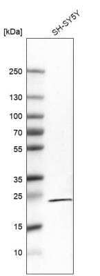 Western Blot: RGS5 Antibody (CL5568) [NBP2-61419] - Analysis in human cell line SH-SY5Y.