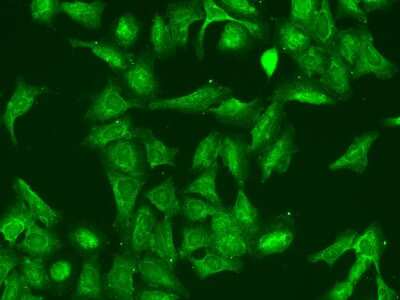 Immunocytochemistry/Immunofluorescence: RGS5 Antibody [NBP2-97906] - Immunofluorescence staining of RGS5 in U2OS cells. Cells were fixed with 4% PFA, permeabilzed with 0.1% Triton X-100 in PBS, blocked with 10% serum, and incubated with rabbit anti-Human RGS5 polyclonal antibody (dilution ratio 1:200) at 4C overnight. Then cells were stained with the Alexa Fluor(R)488-conjugated Goat Anti-rabbit IgG secondary antibody (green). Positive staining was localized to Cytoplasm.