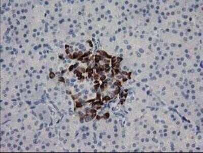 Immunohistochemistry: RGS5 Antibody (OTI1C1) - Azide and BSA Free [NBP2-73887] - Staining of paraffin-embedded Human pancreas tissue within the normal limits using anti-RGS5 mouse monoclonal antibody. (Heat-induced epitope retrieval by 10mM citric buffer, pH6.0, 100 degrees C for 10min)