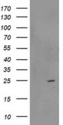 Western Blot: RGS5 Antibody (OTI1C1) - Azide and BSA Free [NBP2-73887] - HEK293T cells were transfected with the pCMV6-ENTRY control (Left lane) or pCMV6-ENTRY RGS5 (Right lane) cDNA for 48 hrs and lysed. Equivalent amounts of cell lysates (5 ug per lane) were separated by SDS-PAGE and immunoblotted with anti-RGS5.