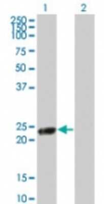 Western Blot: RGS5 Antibody [NBP2-24944] - Analysis of RGS5 in 1) transfected 293T cells and 2) untransfected 293T cells using NBP2-24944 at 1:500.