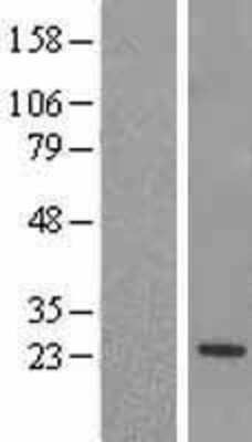 Western Blot: RGS5 Overexpression Lysate (Adult Normal) [NBL1-15335] Left-Empty vector transfected control cell lysate (HEK293 cell lysate); Right -Over-expression Lysate for RGS5.