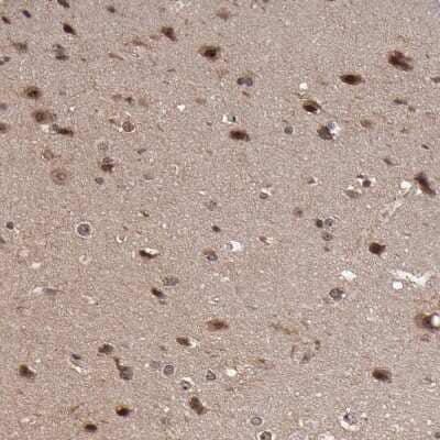 Immunohistochemistry-Paraffin: RGS6 Antibody [NBP1-86524] - Staining of human cerebral cortex shows moderate nuclear and cytoplasmic positivity in neurons.