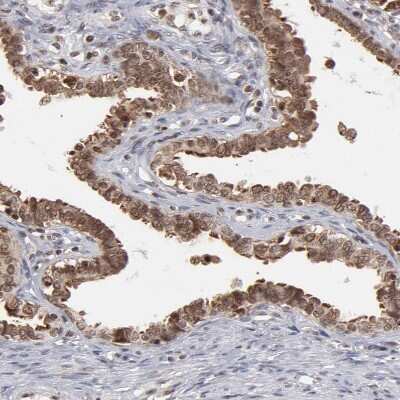 Immunohistochemistry-Paraffin: RGS6 Antibody [NBP1-86524] - Staining of human Fallopian tube shows moderate cytoplasmic  and nuclear positivity in glandular cells.