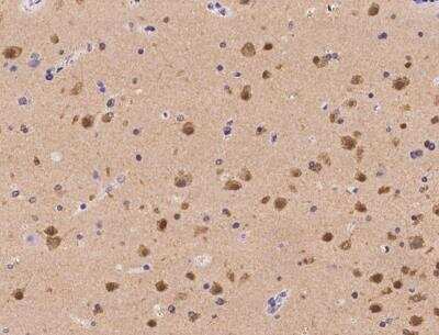 Immunohistochemistry-Paraffin: RGS6 Antibody [NBP3-06581] - Staining of human RGS6 in human brain with rabbit polyclonal antibody at 1:1000 dilution.